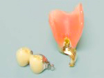 マルチコンアタッチメントの入れ歯